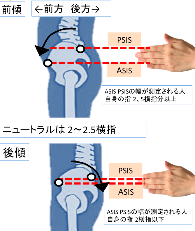 骨盤